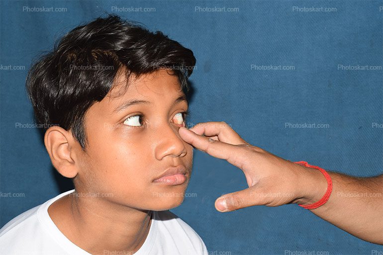 An Indian Doctor Checking Patient Eyes